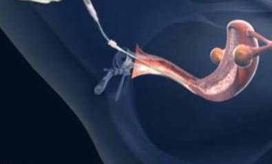 2026赣州哪家医院可以做试管？从这三方面选择很重要